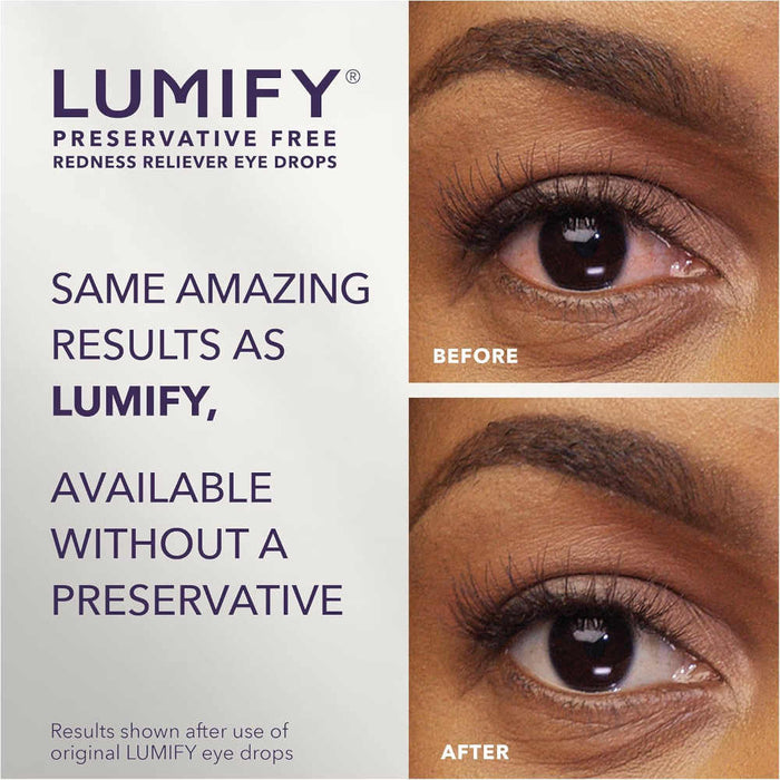 LUMIFY Redness Reliever Eye Drops UK