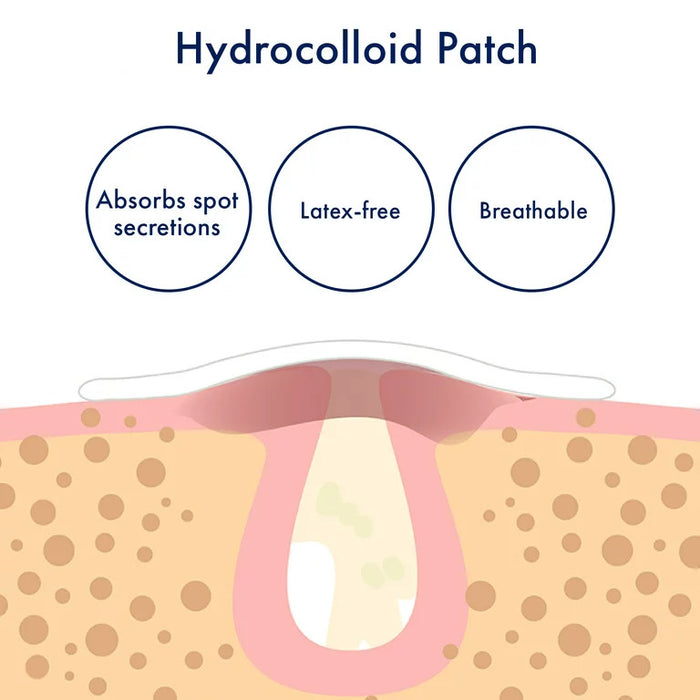 Panoxyl PM Overnight Spot Patches 40 Count Banner Showing How The Hydrocolloid Patch Penetrates The Skin