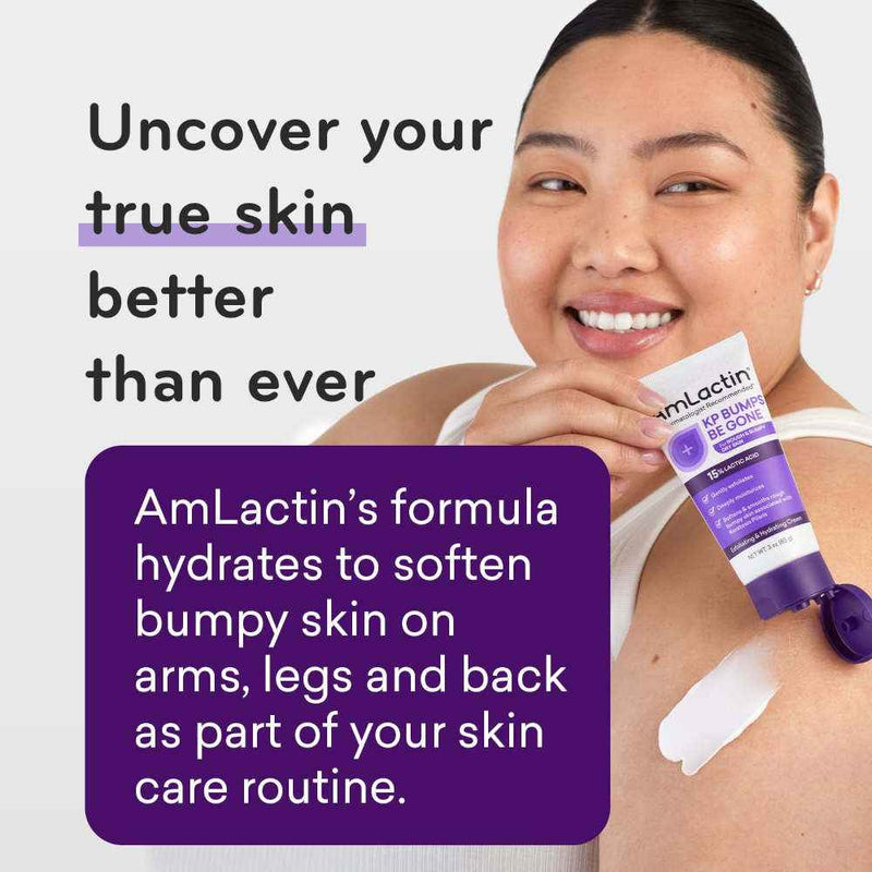 AmLactin KP Bumps Be Gone 15% Lactic Acid Cream