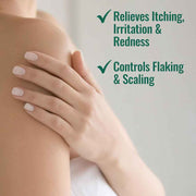 Nizoral Psoriasis Relief Cream 4 Oz