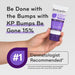 Amlactin KP Bumps Be Gone 15% Lactic Acid Moisturizing Cream 3 Oz Banner That Reads - Be Done With Bumps
