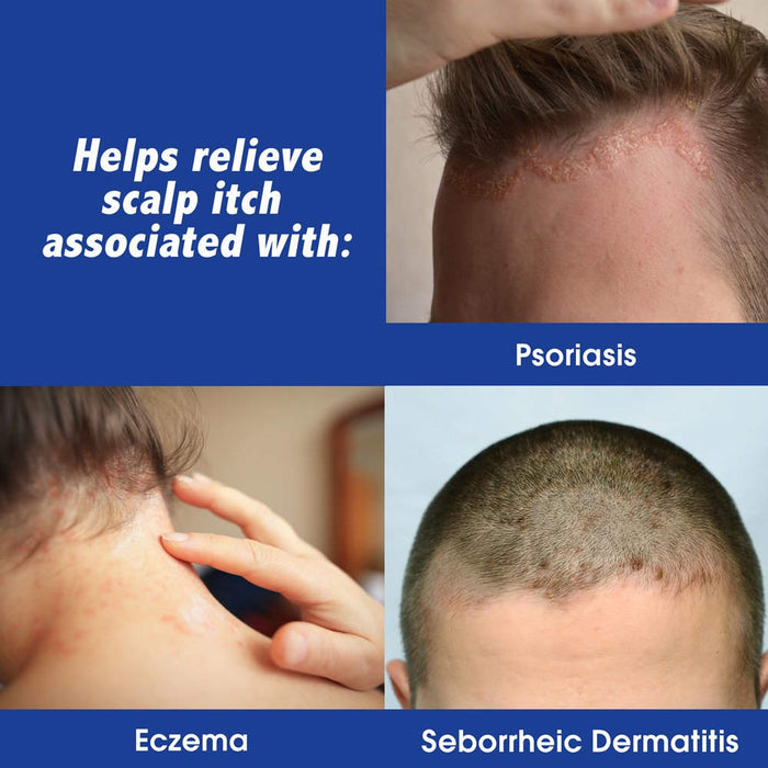Scalpicin Maximum Strength Hydrocortisone 1% Anti-Itch Scalp Relief Liquid  1.5 Oz Banner Showing Different Treatment Types