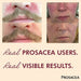 Prosacea Medicated Gel, Heals Rosacea Symptoms of Redness, Pimples and Irritation, 0.75 oz Banners Showing Before And After Pictures On Two People