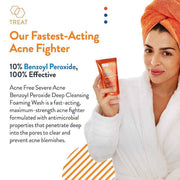 AcneFree Severe Acne 10% Benzoyl Peroxide  Wash 5 Oz