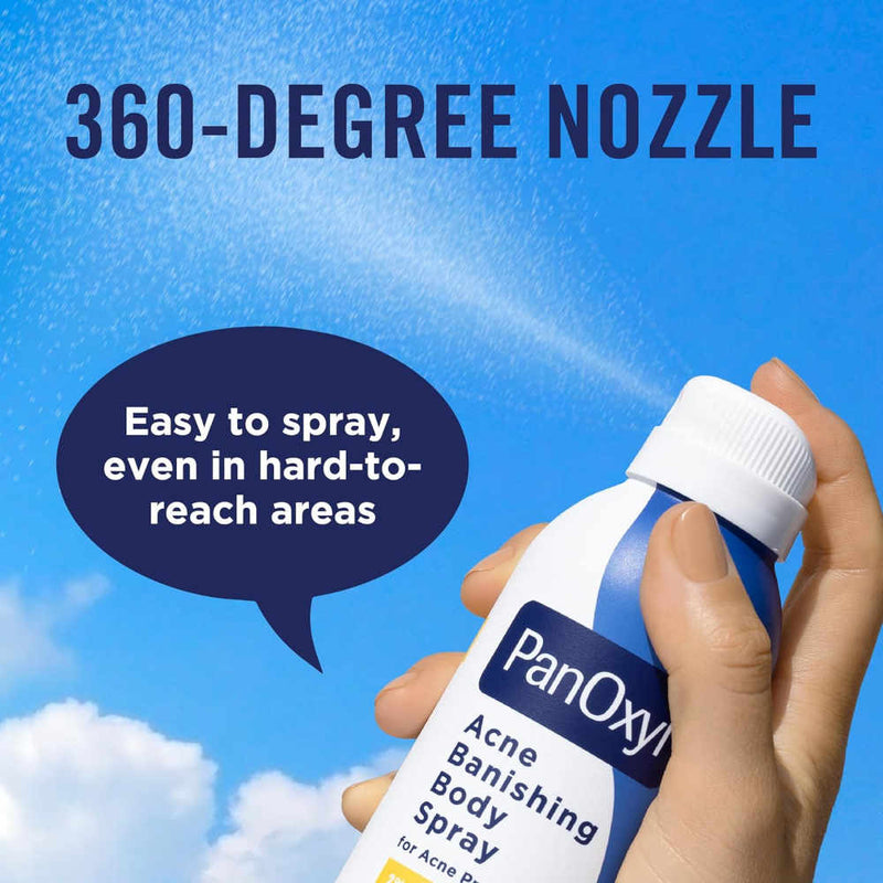 Hand holding a PanOxy acne banishing body spray with a blue sky background and text about the 360-degree nozzle.