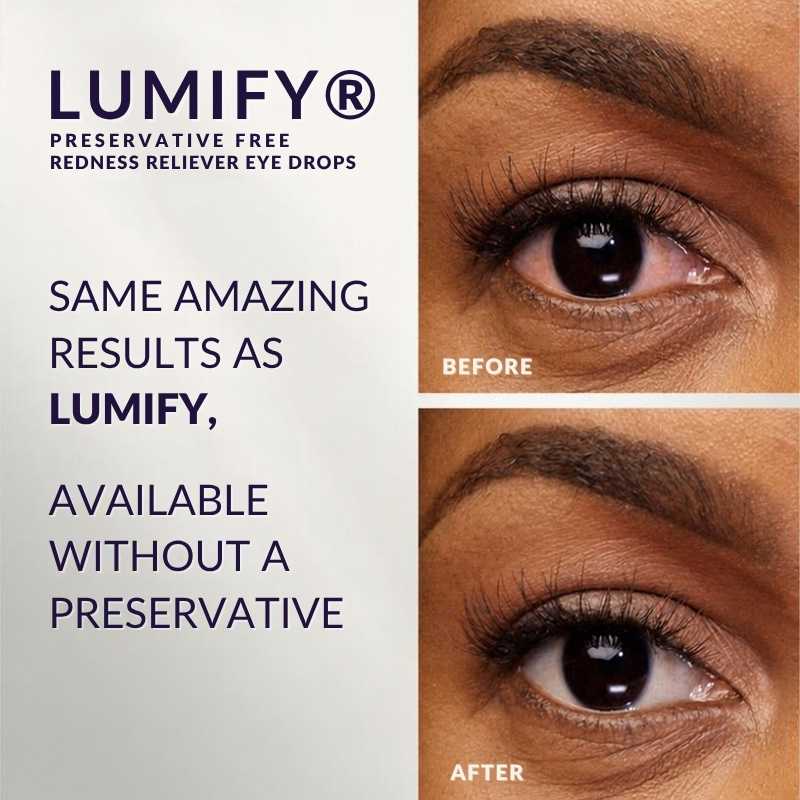 Promotional graphic for LUMIFY eye drops showing a split-screen before/after comparison of a human eye on the right, with product text on the left: 'LUMIFY PRESERVATIVE FREE REDNESS RELIEVER EYE DROPS' and 'SAME AMAZING RESULTS AS LUMIFY, AVAILABLE WITHOUT A PRESERVATIVE'.