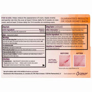 Mederma Scar Cream, +SPF 30, 20g Tube UK