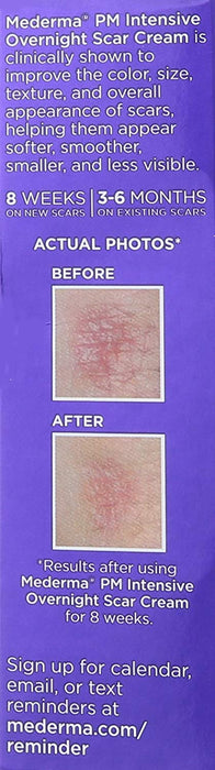 Mederma PM Intensive Overnight Scar Cream 1 oz UK