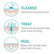 CeraVe Benzoyl Peroxide Acne Foaming Cleanser, 5 Oz