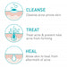 CeraVe Acne Foaming Cleanser 5 Oz banner showing product treatment stages