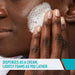 CeraVe Acne Foaming Cleanser 5 Oz banner showing person using product to wash their face